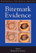 Bitemark Evidence