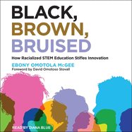 Black, Brown, Bruised: How Racialized Stem Education Stifles Innovation