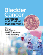 Bladder Cancer: Diagnosis and Clinical Management