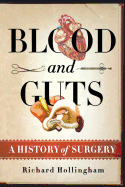 Blood and Guts: A History of Surgery