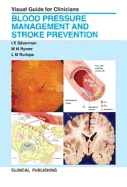 Blood Pressure Management and Stroke Prevention: Visual Guide for Clinicians