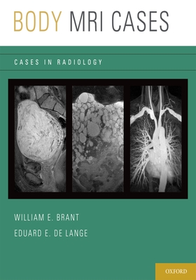 Body MRI Cases - Brant