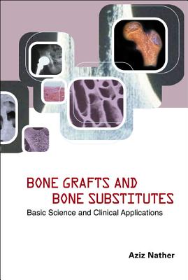 Bone Grafts and Bone Substitutes: Basic Science and Clinical Applications - Nather, Abdul Aziz (Editor)