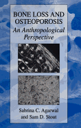 Bone Loss and Osteoporosis: An Anthropological Perspective