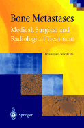 Bone Metastases: Medical, Surgical and Radiological Treatment