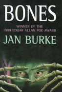 Bones