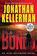 Bones