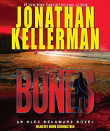 Bones
