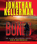 Bones