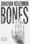 Bones