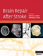 Brain Repair After Stroke