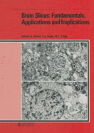 Brain Slices: Fundamentals, Applications, and Implications