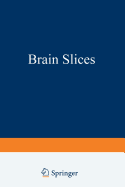 Brain Slices
