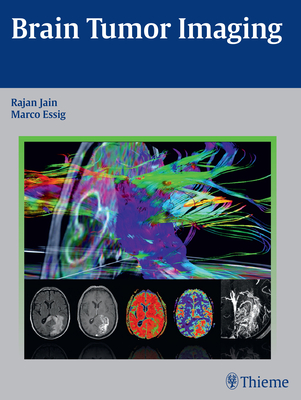 Brain Tumor Imaging - Jain, Rajan, and Essig, Marco