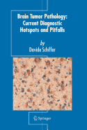 Brain Tumor Pathology: Current Diagnostic Hotspots and Pitfalls