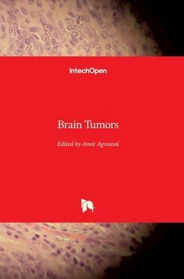 Brain Tumors - Agrawal, Amit (Editor)
