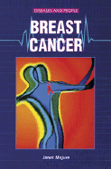Breast Cancer - Majure, Janet