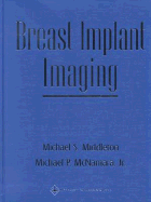 Breast Implant Imaging
