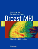Breast MRI: Diagnosis and Intervention