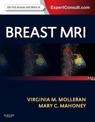 Breast MRI - Molleran, Virginia, and Mahoney, Mary C, MD