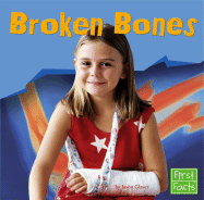 Broken Bones