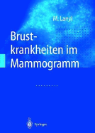 Brustkrankheiten Im Mammogramm: Diagnostik Und Pathomorphologische Bildanalyse