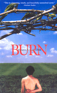 Burn