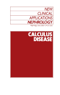 Calculus Disease