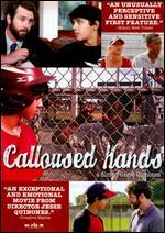 Calloused Hands