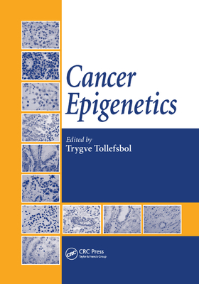 Cancer Epigenetics - Tollefsbol, Trygve (Editor)