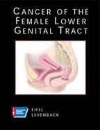 CANCER OF FEMALE LOWER GENITAL TRACT