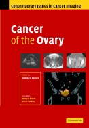 Cancer of the Ovary
