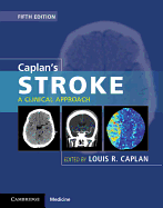 Caplan's Stroke: A Clinical Approach