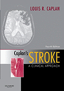 Caplan's Stroke: A Clinical Approach