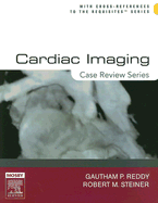 Cardiac Imaging: Case Review Series