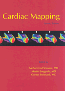 Cardiac Mapping
