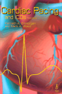 Cardiac Pacing and Icds