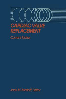 Cardiac Valve Replacement: Current Status - Matloff, Jack M (Editor)