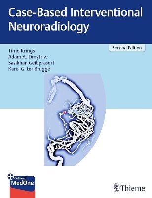 Case-Based Interventional Neuroradiology - Krings, Timo, and Dmytriw, Adam, and Geibprasert, Sasikhan