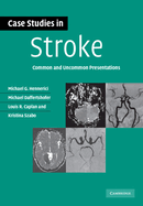 Case Studies in Stroke: Common and Uncommon Presentations