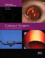 Cataract Surgery: FCO Series - Coombes, Andrew (Editor), and Gartry, David (Editor)