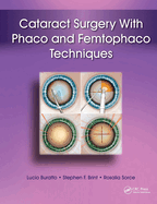 Cataract Surgery with Phaco and Femtophaco Techniques