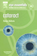 Cataract - Malhotra, Raman