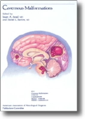 Cavernous Malformations - Awad, Issam A, MD (Editor), and Barrow, Daniel Louis (Editor)