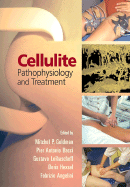 Cellulite: Pathophysiology and Treatment