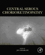 Central Serous Chorioretinopathy