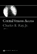 Central Venous Access