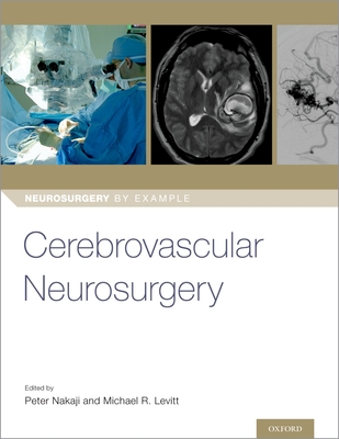 Cerebrovascular Neurosurgery - Nakaji, Peter (Editor), and Levitt, Michael (Editor)