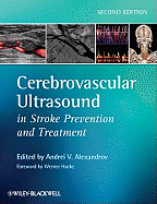 Cerebrovascular Ultrasound in Stroke Prevention and Treatment