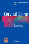 Cervical Spine: Minimally Invasive and Open Surgery